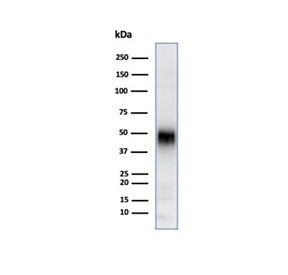 Western blot testing of human Jurkat cell lysate using CD2 antibody (clone LFA2/7106). Expected mole