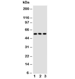 Western blot testing of GLUT5 antibody and Lane 1: rat kidney; 2: rat liver; 3: mouse kidney tissue 
