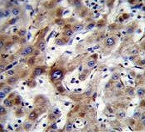 ADP,ATP carrier protein 3 Antibody / ANT-3 / SLC25A6