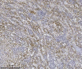 IHC staining of FFPE human spleen tissue with Integrin linked ILK antibody. HIER: boil tissue sectio