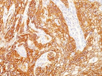 EGF Receptor / EGFRvIII Antibody