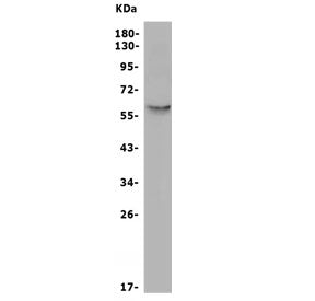 SLC2A10 Antibody / GLUT10