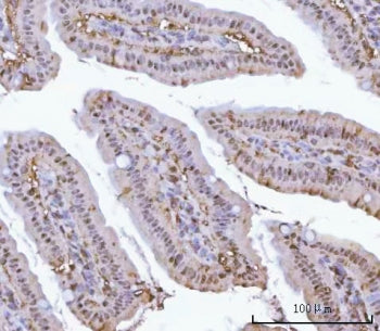 PSMA1 Antibody / Proteasome 20S alpha 1