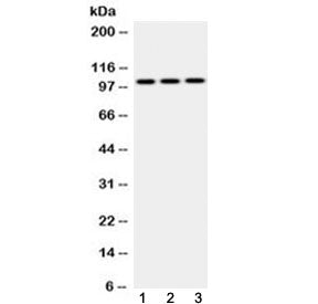 Western blot testing of 1) rat testis, 2) mouse brain and 3) human MCF7 cell lysate with AP2B1 antib