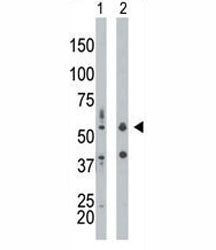 PKR Antibody (PRKR)