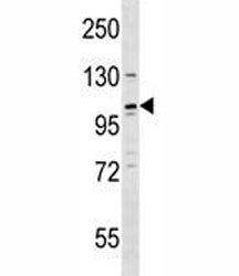 REST Antibody