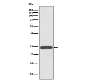Growth Hormone Antibody / GH1