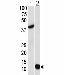 SUMO3 Antibody