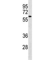 IRAK4 antibody western blot analysis in NCI-H460 lysate. Predicted molecular weight 52/37 kDa (isofo