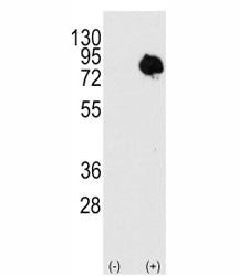 Transglutaminase 2 Antibody