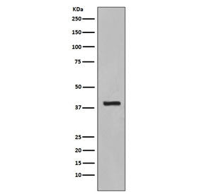 KRT19 Antibody / Cytokeratin 19