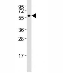 MMP14 Antibody