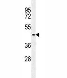 TMPRSS11E2 Antibody