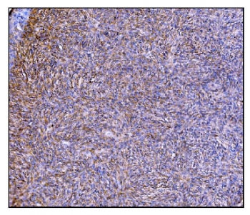 PREP Antibody / Prolyl Endopeptidase