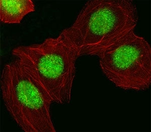 Fluorescent image of A549 cell stained with HMGA1 antibody at 1:25. HMGA1 immunoreactivity is locali