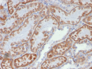 FGF-23 Antibody / Fibroblast Growth Factor 23