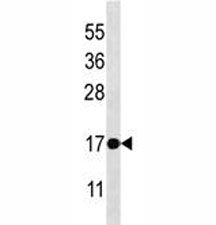 BAX Antibody