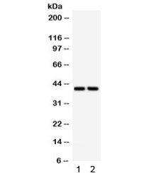 Western blot testing of 1) rat heart and 2) human SKOV lysate with SFRP4 antibody. Routinely observe