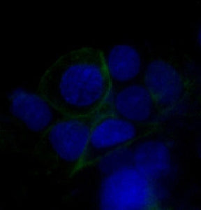 GLUT1 Antibody / SLC2A1