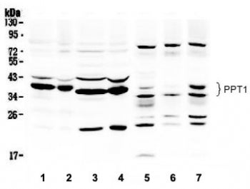 Western blot testing of 1) rat brain, 2) mouse brain, 3) rat liver, 4) mouse liver, 5) human HepG2, 