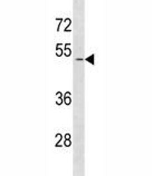 SMAD1 Antibody