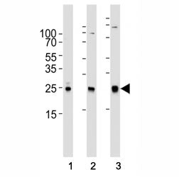 RAC1 Antibody