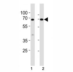 Western blot analysis of lysate from mouse (1) small intestine and (2) testis tissue lysate using Kl