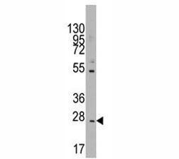 CD8B Antibody