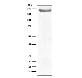 Neurofilament Antibody (-Heavy) / NF-H / NEFH