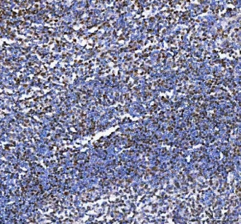 IHC staining of FFPE human tonsil tissue with Aiolos antibody. HIER: boil tissue sections in pH8 EDTA for 20 min and allow to cool before testing.