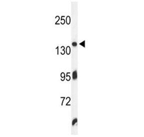 ZO-1 Antibody (TJP1)