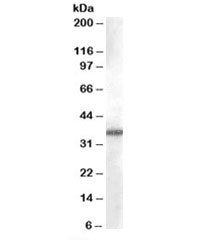 AKR1B10 Antibody