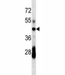 CD79a Antibody