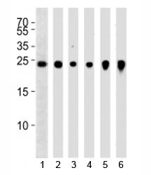 UCHL1 Antibody