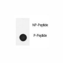 Dot blot analysis of phospho-Nephrin antibody. 50ng of phos-peptide or nonphos-peptide per dot were 