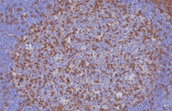 CD3 epsilon Antibody