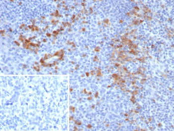IHC staining of FFPE human tonsil tissue with B7-H3 antibody (clone B7H3/4479) at 2ug/ml. Inset: PBS