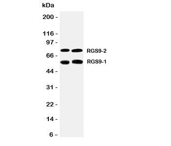 Western blot testing of RGS9 antibody and Lane 1: rat brain; 2: mouse brain tissue lysate. Predicted