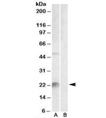 Kallikrein 6 Antibody