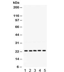 Western blot testing of 1) rat testis, 2) rat lung, 3) human 293, 4) human HeLa and 5) human HepG2 l