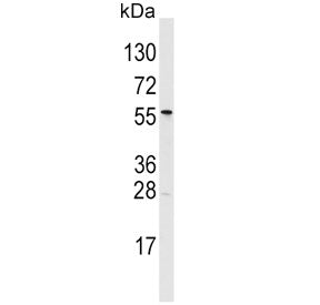 ALDH6A1 Antibody