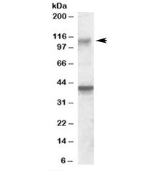 Western blot testing of rat brain lysate with GRIK3 antibody at 0.3ug/ml. The expected ~110kDa band 