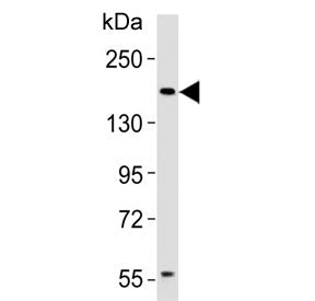 Western blot analysis of lysate MCF-7 cells using Insulin Receptor Related antibody at 1:1000. Expec