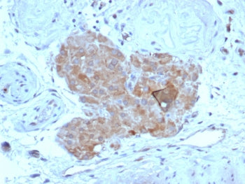 IHC staining of FFPE human testis tissue with Anti-Mullerian Hormone antibody (clone AMH/7354). HIER