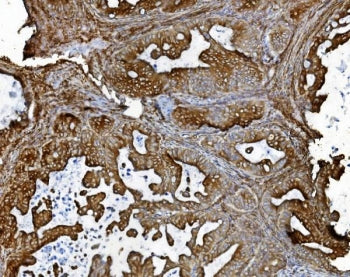 PDIR Antibody / Protein disulfide isomerase-related protein / PDIA5