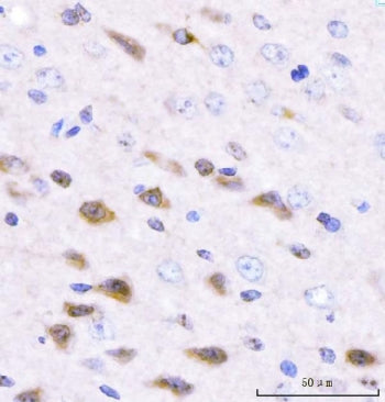 IHC staining of FFPE mouse brain tissue with Adgrg1 antibody. HIER: boil tissue sections in pH8 EDTA