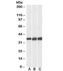 Lactate Dehydrogenase B Antibody