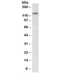 Western blot testing of human cerebellum lysate with RIP140 antibody at 0.5ug/ml. Predicted molecula