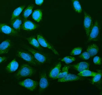 Immunofluorescent staining of FFPE human U-2 OS cells with 40S ribosomal protein S14 antibody (green) and DAPI nuclear stain (blue). HIER: steam section in pH6 citrate buffer for 20 min.