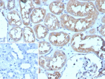 IHC staining of FFPE human kidney tissue with ADCY8 antibody (clone ADCY8/7573). Inset: PBS used in 